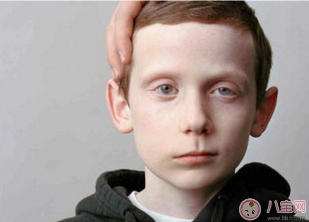 兒童吹空調(diào)竟然導(dǎo)致面癱 如何正確吹空調(diào)