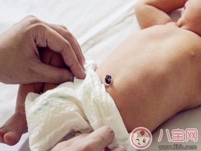 夏季新生兒保健與護(hù)理常識(shí)大普及 夏季新生兒保健與護(hù)理常識(shí)大普及