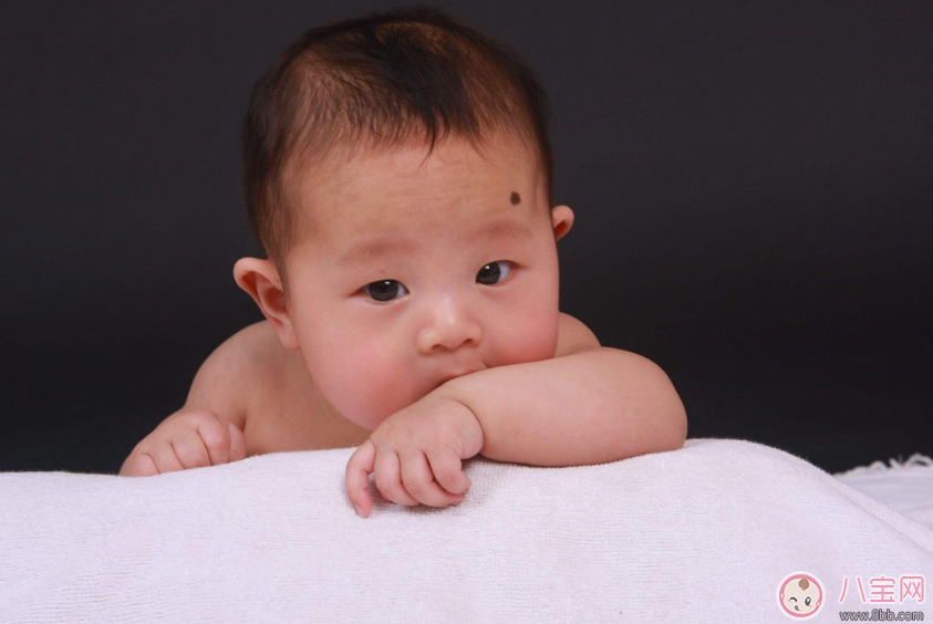 寶寶胎記會(huì)自己掉嗎 寶寶胎記去除方法