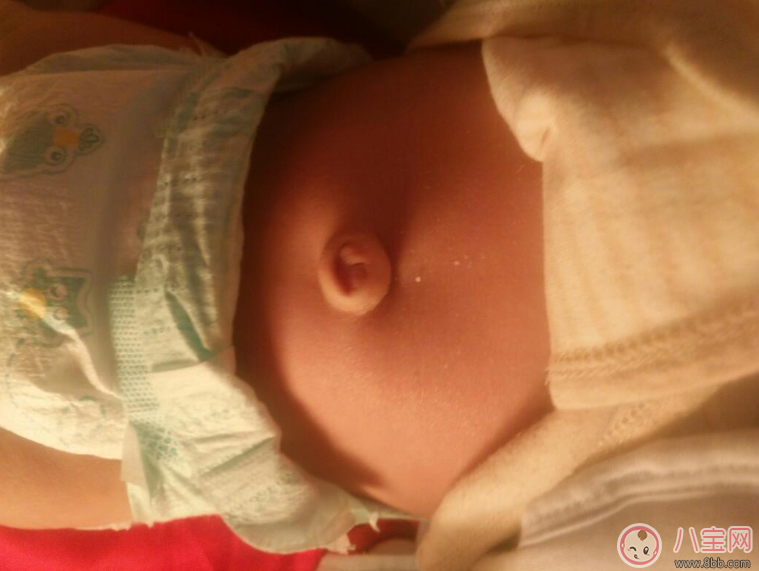 寶寶肚臍護(hù)理有方法 三不要方法要記牢