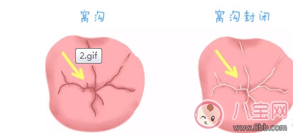 寶寶蛀牙不給醫(yī)生看 如何預(yù)防蛀牙減少寶寶痛苦 寶寶蛀牙不給醫(yī)生看 如何預(yù)防蛀牙減少寶寶痛苦