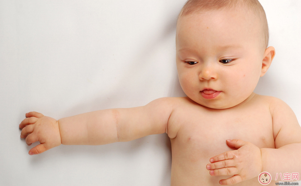糖寶寶在嬰兒時期有哪些癥狀 怎么預(yù)防唐氏綜合癥