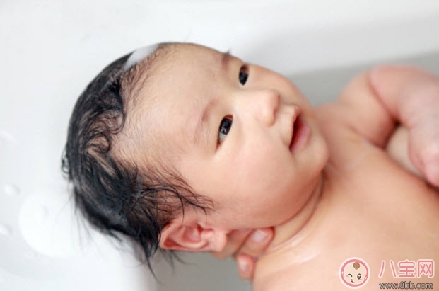 頭垢對寶寶的影響 頭垢怎么去除有哪些注意事項 頭垢對寶寶的影響 頭垢怎么去除有哪些注意事項