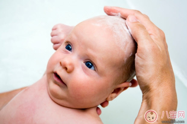 頭垢對寶寶的影響 頭垢怎么去除有哪些注意事項 頭垢對寶寶的影響 頭垢怎么去除有哪些注意事項