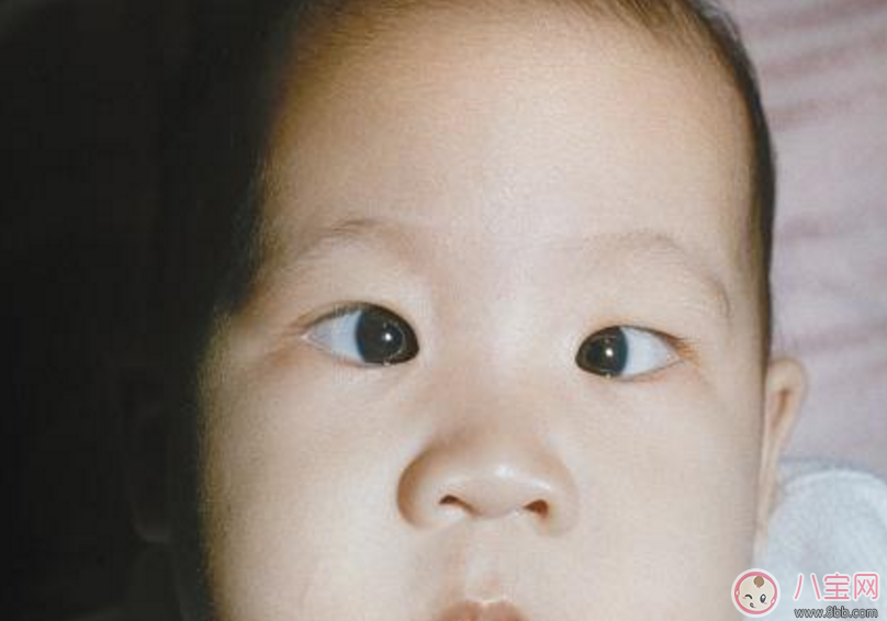 孩子內(nèi)斜視怎么辦 怎么糾正孩子內(nèi)斜視 孩子內(nèi)斜視怎么辦 怎么糾正孩子內(nèi)斜視