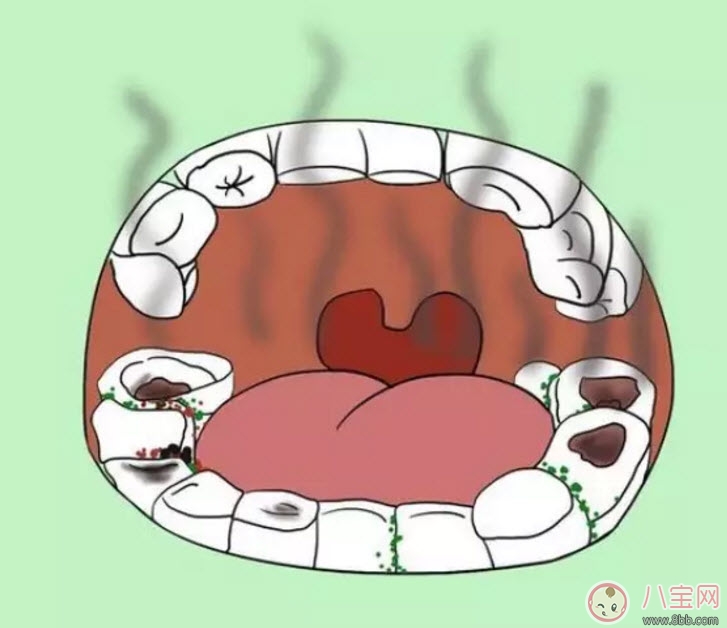 寶寶口臭的原因是什么 小孩子口臭的解決辦法 寶寶口臭的原因是什么 小孩子口臭的解決辦法