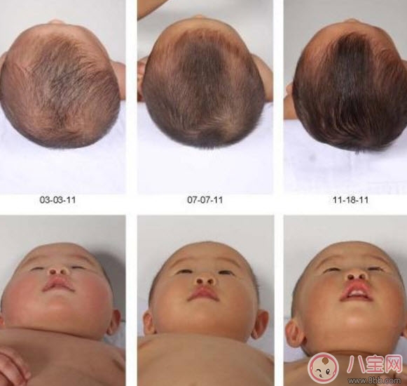 寶寶頭型睡偏了怎么辦 寶寶頭型調(diào)整怎么做