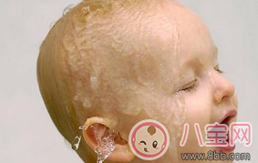 2017三伏天寶寶消化不良引起睡眠性出汗如何調理 2017三伏天寶寶消化不良引起睡眠性出汗如何調理