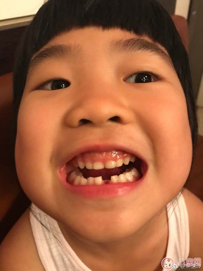 姐姐grace掉牙表情古怪 孩子什么時(shí)候掉牙最好