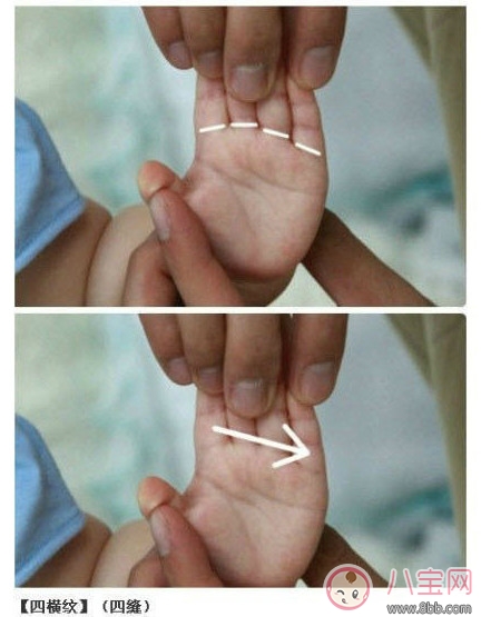 寶寶推拿大全 嬰幼兒常見病的最強(qiáng)克星