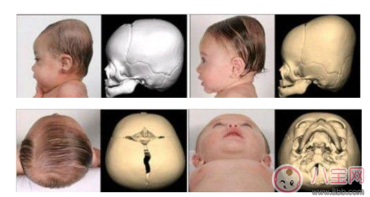 這些老方法，請不要再用到孩子的身上
