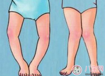 嬰兒扶站 寶寶過早被扶站的弊端(平衡感 O形腿 不愛爬) 嬰兒扶站 寶寶過早被扶站的弊端(平衡感 O形腿 不愛爬)