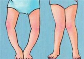 嬰兒扶站 寶寶過早被扶站的弊端(平衡感 O形腿 不愛爬)