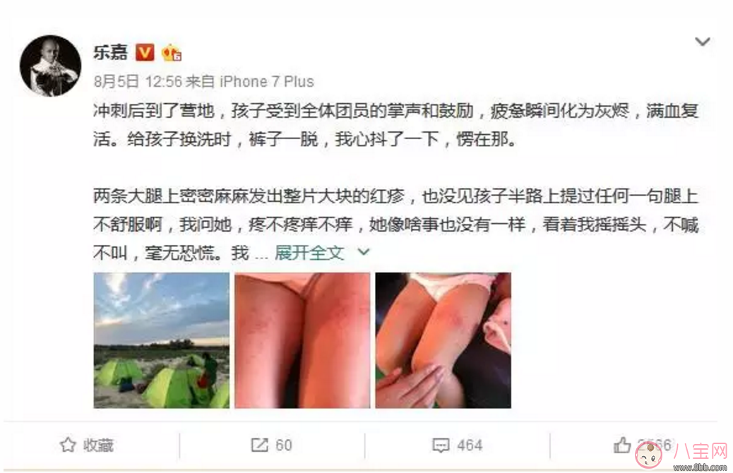 樂嘉帶4歲女兒穿越沙漠徒步76公里 女兒腿上發(fā)滿皰疹 樂嘉帶4歲女兒穿越沙漠徒步76公里 女兒腿上發(fā)滿皰疹