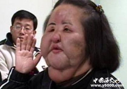 韓國風(fēng)扇女去世韓國風(fēng)扇女簡歷風(fēng)扇女為什么會(huì)癡迷整容 韓國風(fēng)扇女去世韓國風(fēng)扇女簡歷風(fēng)扇女為什么會(huì)癡迷整容