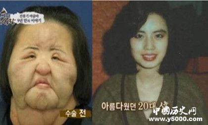 韓國風(fēng)扇女去世韓國風(fēng)扇女簡歷風(fēng)扇女為什么會(huì)癡迷整容 韓國風(fēng)扇女去世韓國風(fēng)扇女簡歷風(fēng)扇女為什么會(huì)癡迷整容