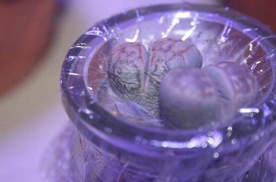 生石花怎么水培，教你四個(gè)基本步驟快速水培生根