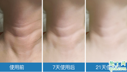 米加頸霜有沒有效果 米加頸霜使用評(píng)測(cè)6