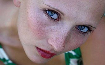 臉上有斑吃香菜會不會加重 臉上斑加重了怎么辦