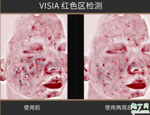 菜鳥和配方師精華好用嗎 菜鳥和配方師黑金姜黃素精華評(píng)測(cè)6