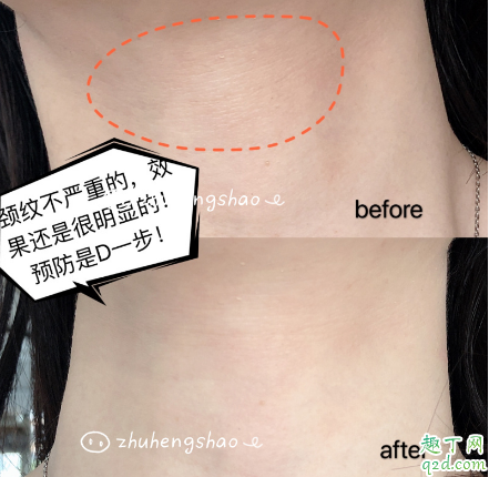 米加頸霜有沒有效果 米加頸霜使用評(píng)測(cè)4