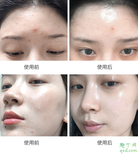 科娜藍面霜好用嗎 科娜藍面霜使用評測3