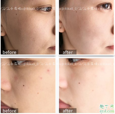 貝歐夢(mèng)特谷胱甘肽美白精華怎么樣 貝歐夢(mèng)特美白精華使用感受5