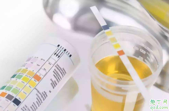 孕期不胖可以不做糖篩嗎 糖篩什么時(shí)候做多少周2