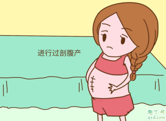 剖宮產(chǎn)橫剖豎剖哪個好 第二次剖腹產(chǎn)是在原傷口上剖嗎2